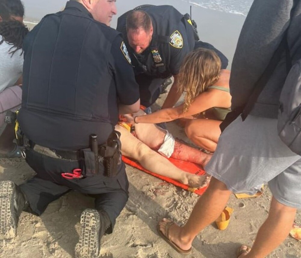 На пляже Нью-Йорка акула набросилась на эмигрантку из Украины