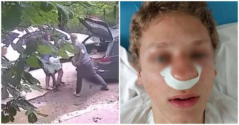 Мужчина сломал нос подростку из-за замечания о припаркованном у подъезда автомобиле