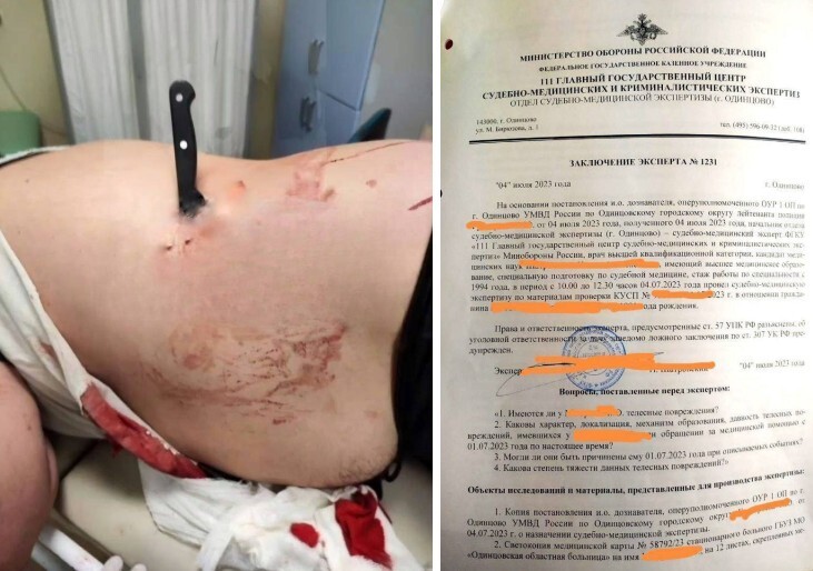 В подмосковном Одинцово мигрант воткнул нож в бок местному жителю