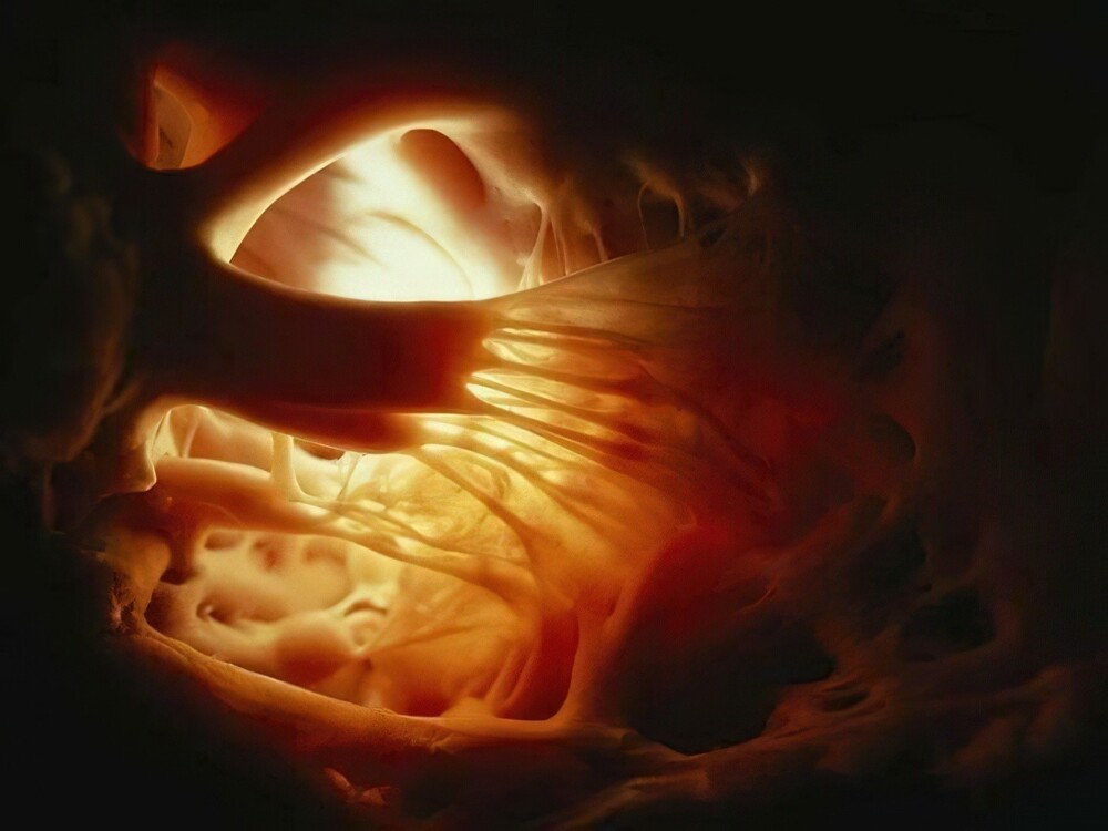 11. Невероятная фотография сердечных струн внутри сердца