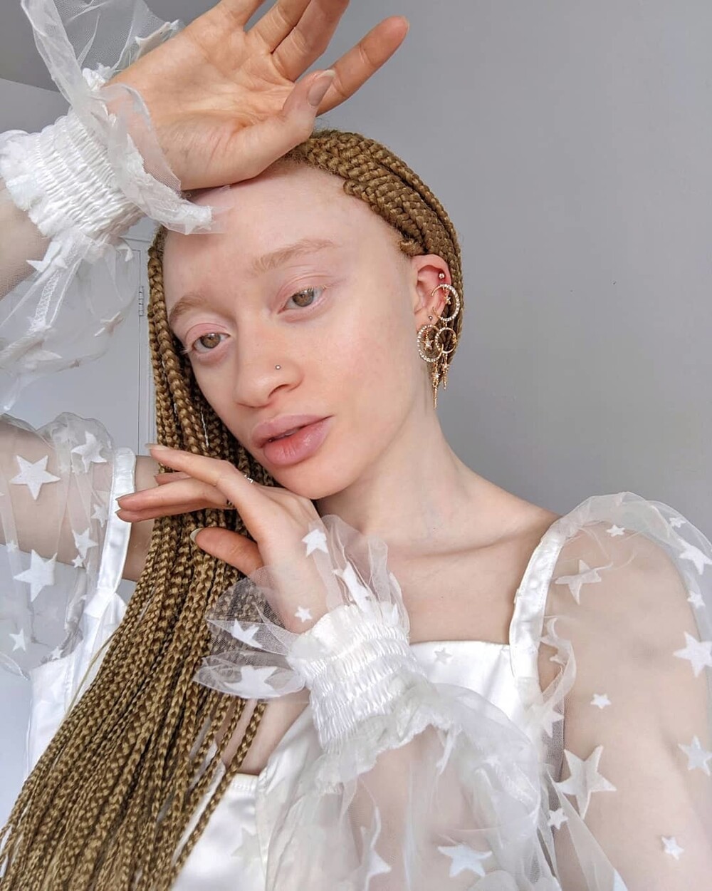 Необычные гены: западноафриканская модель с альбинизмом