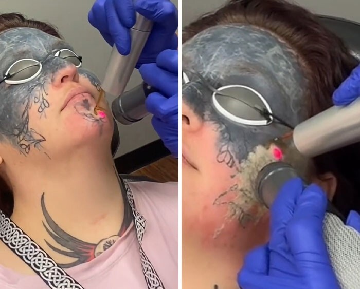 Женщине, чьё лицо было изуродовано татуировкой против её воли, помог видеоблогер