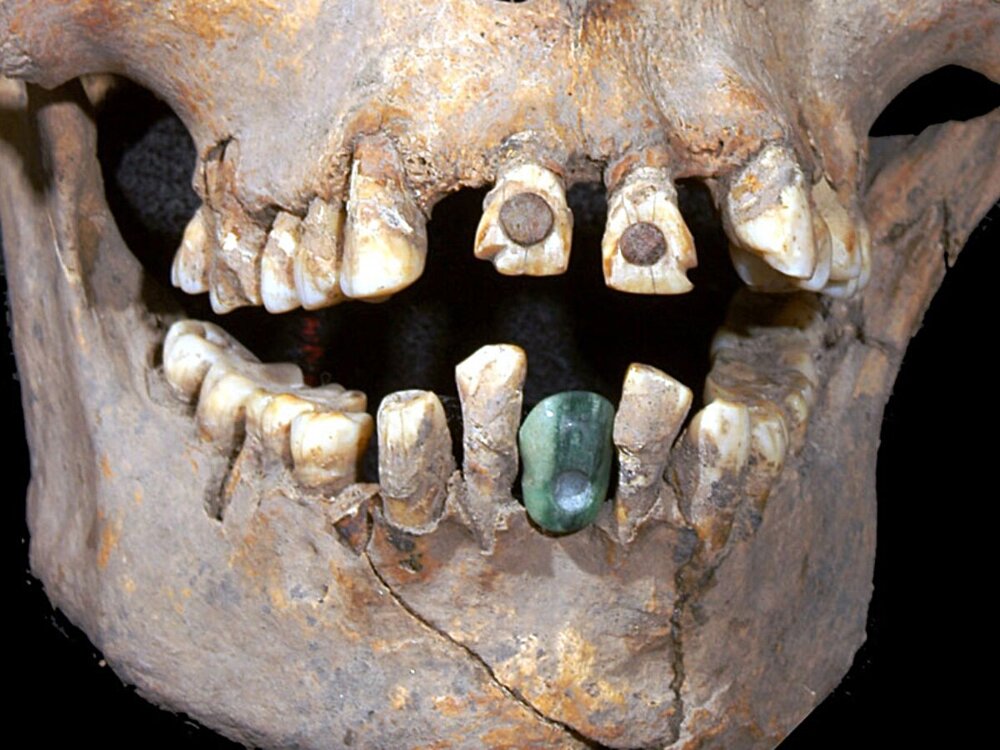 Как и зачем древние майя украшали зубы драгоценными камнями
