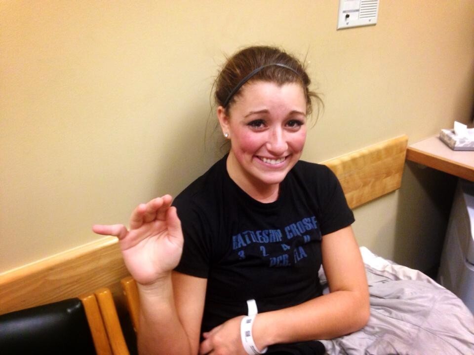 2. "Моя подруга сломала палец на тренировке по волейболу"