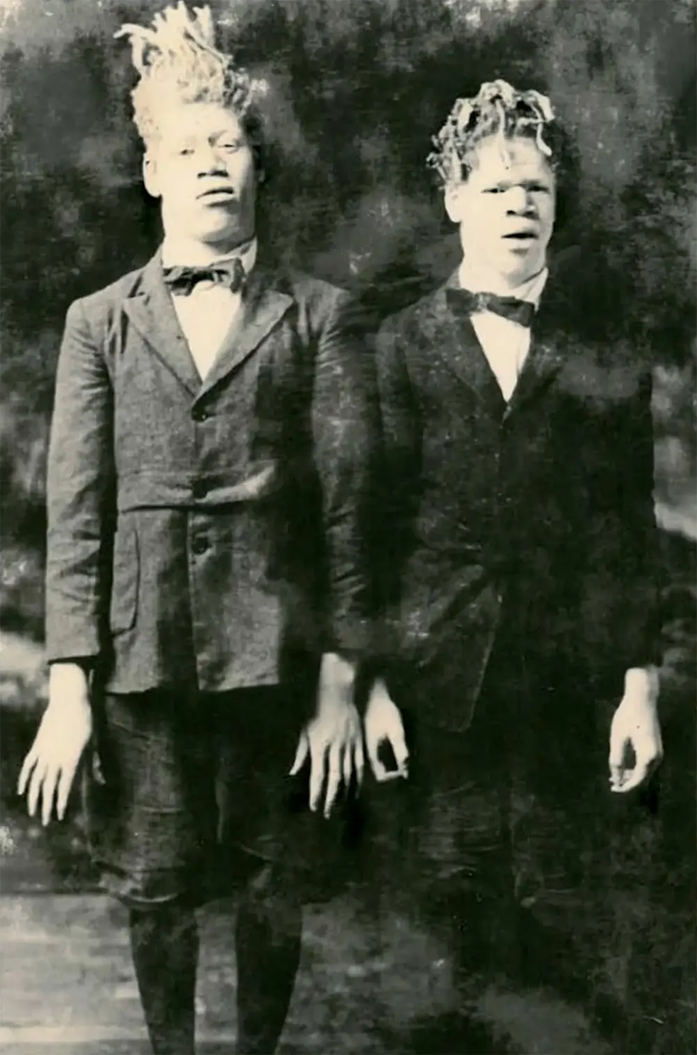 Джордж и Вилли Мьюз на самой ранней известной фотографии в цирке
