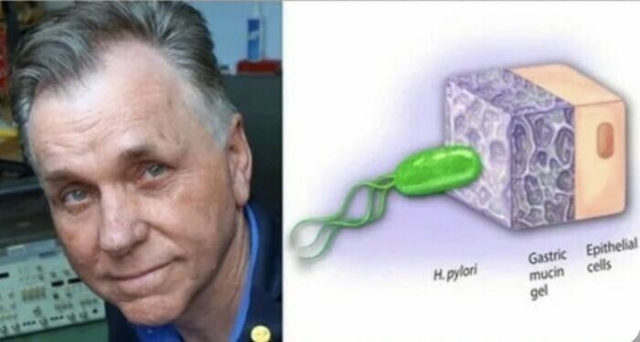 10. Барри Маршалл был убежден, что бактерия Helicobacter Pylori вызывает язву желудка, но ему никто не верил
