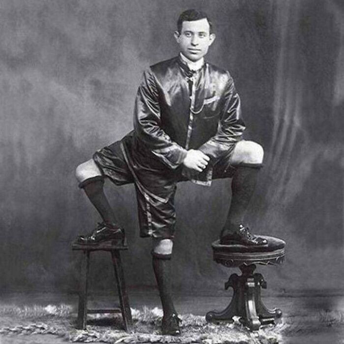 22. Это Франческо Лентини, трехногий человек. Итало-американский артист цирка родился с тремя ногами, четырьмя ступнями и двумя наборами функционирующих гениталий