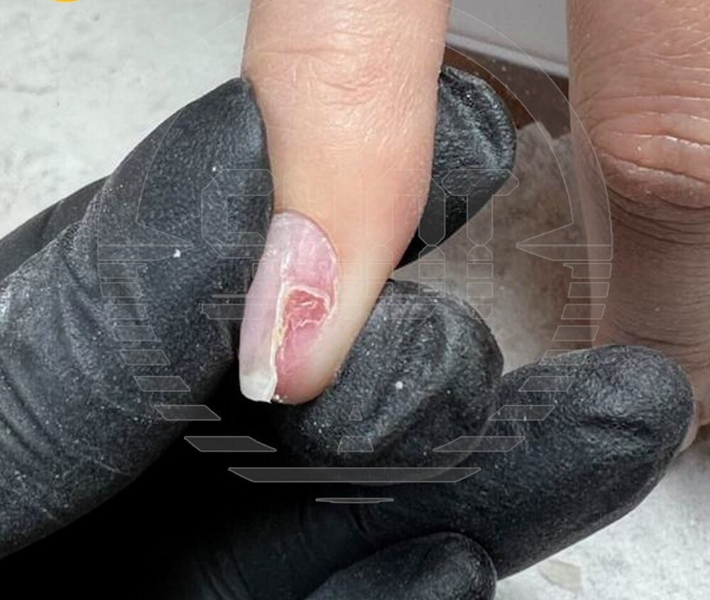 В Москве девушка лишилась ногтей после нескольких сеансов маникюра