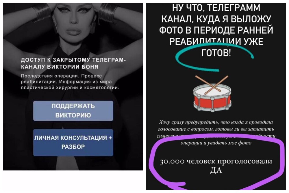 Торг лицом: Виктория Боня захотела "отбить" затраты на пластику и пообещала показать себя после операции за взнос в 1300 рублей