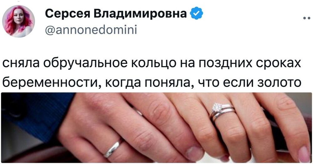 "В браке, но кольцо не ношу": мужья и жёны рассказали, как относятся к символу на руке после свадьбы
