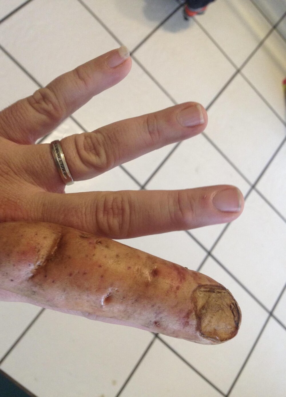 5. Картофель, который очень похож на палец