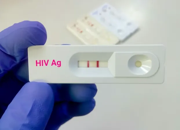 13-летняя ВИЧ-инфицированная школьница из Москвы сознательно заразила своего знакомого