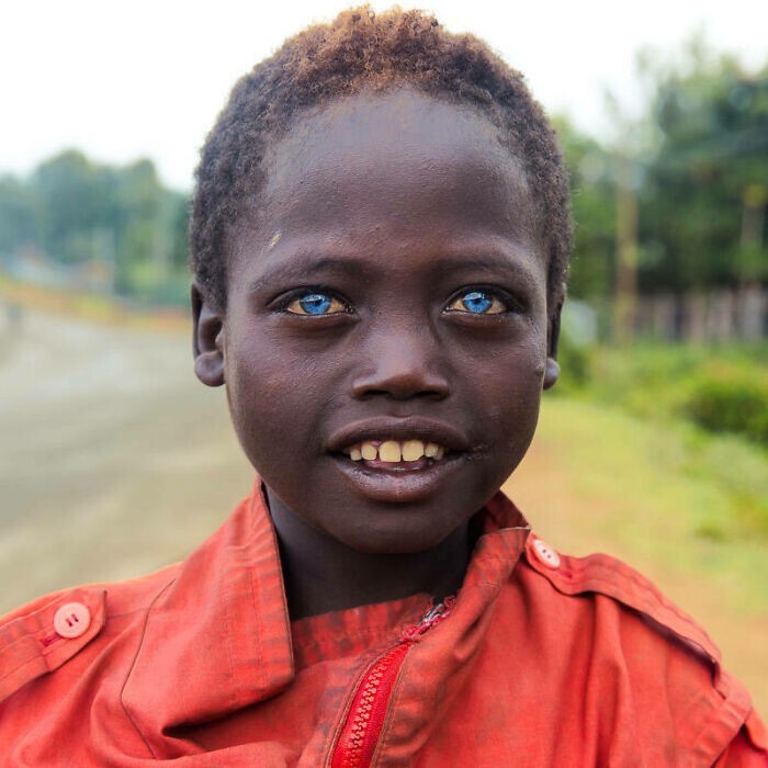 26. Эфиопский мальчик-попрошайка с голубыми глазами на улицах Джинки