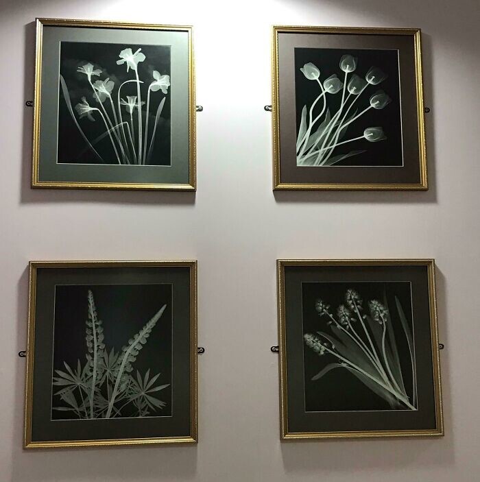 2. Комната ожидания рядом с рентгеновским кабинетом в больнице украшена картинами. Это цветы — рентгеновские снимки
