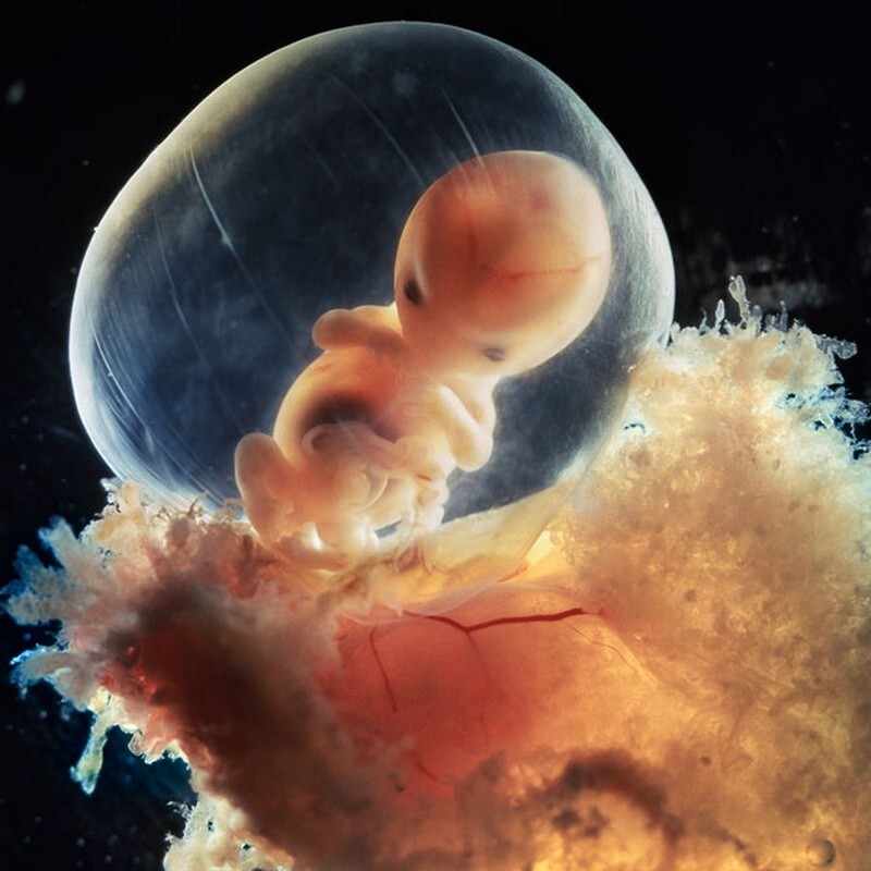 5. Человеческий эмбрион приобретает отпечатки пальцев в течение трех месяцев после зачатия