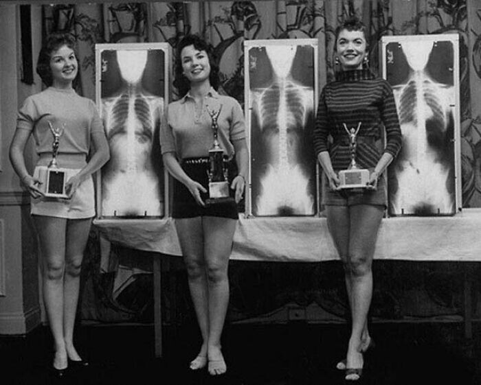 32. Победительницы конкурса "Мисс идеальная осанка" на съезде хиропрактиков, 1956 г.