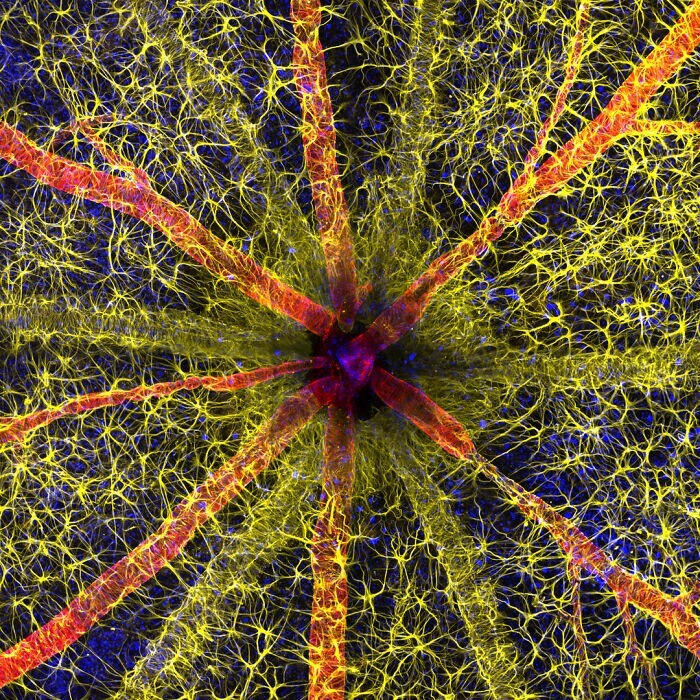 23. Головка зрительного нерва грызуна. Здесь видны клетки астроциты (жёлтый), сократительные белки (красный) и сосудистая оболочка сетчатки (зелёный). Снимок занял первое место. Фотограф - Hassanain Qambari