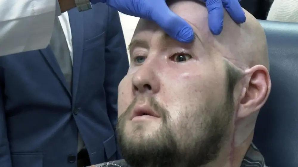 В США провели первую в мире пересадку целого глаза 