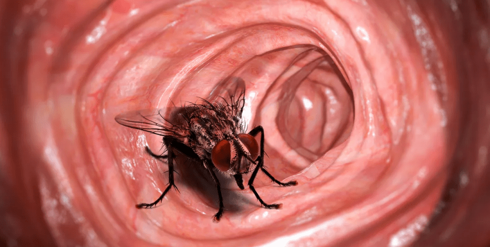 Врачи обнаружили живую муху в толстой кишке пациента