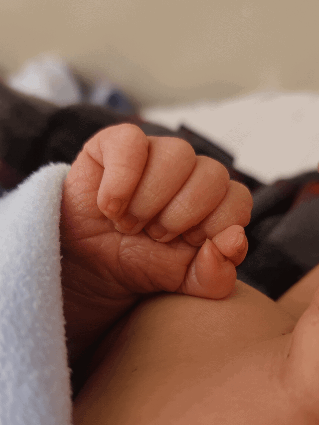 Ребёнок родился с дополнительным большим пальцем