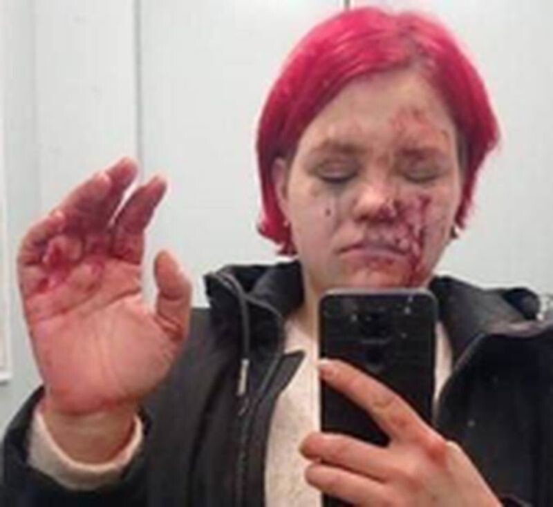 Таксист жестоко избил девушку из-за надорванной 100-рублёвой купюры