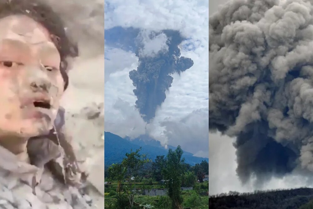 Туристка выжила во время извержения вулкана Мерапи и показала обожжённое лицо