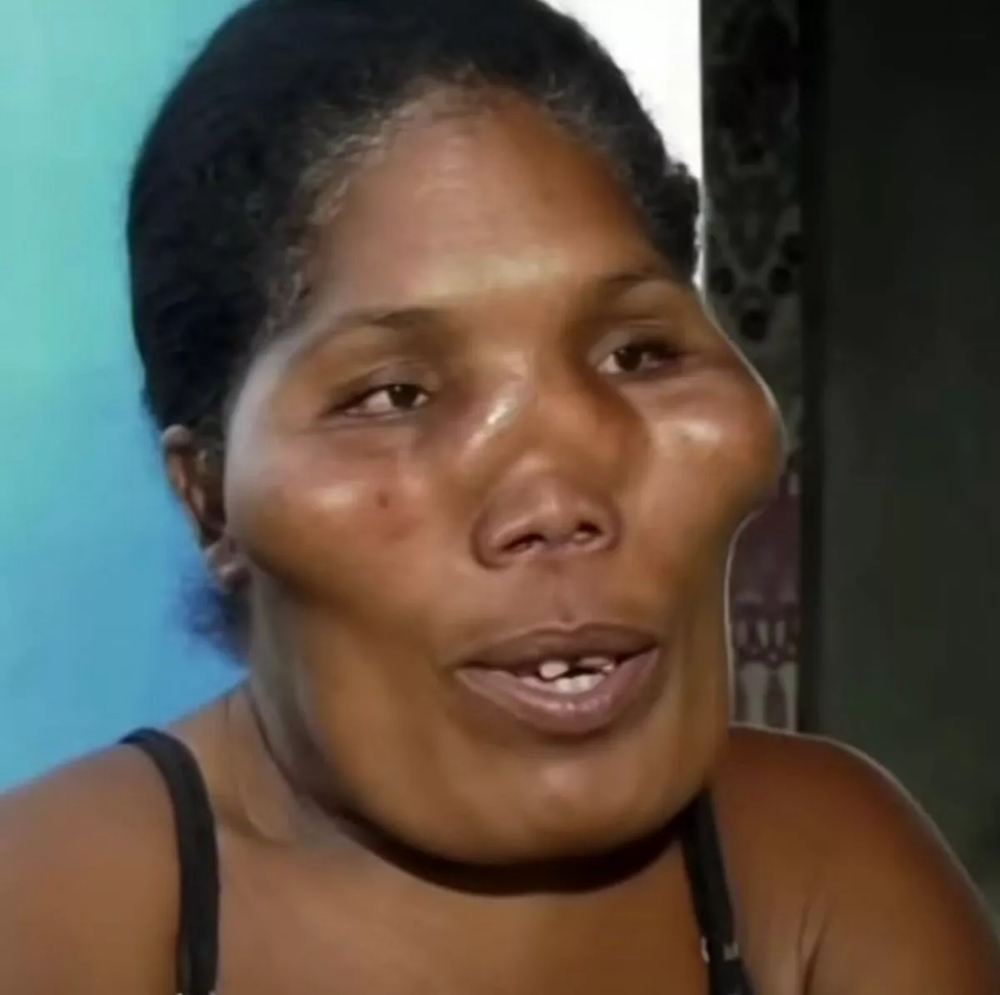 Странная болезнь превратила половину доминиканской семьи в пришельцев