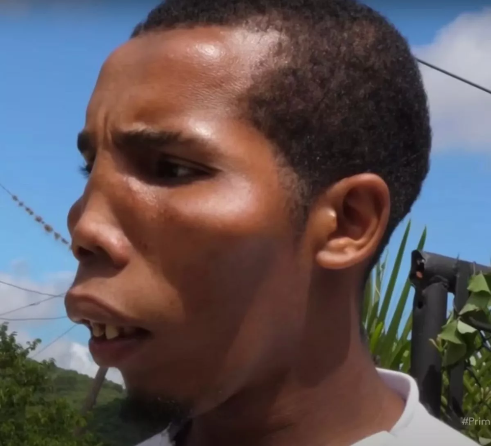 Странная болезнь превратила половину доминиканской семьи в пришельцев