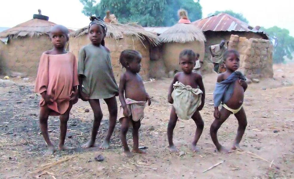 Почему у африканских детей часто бывают такие большие животы?