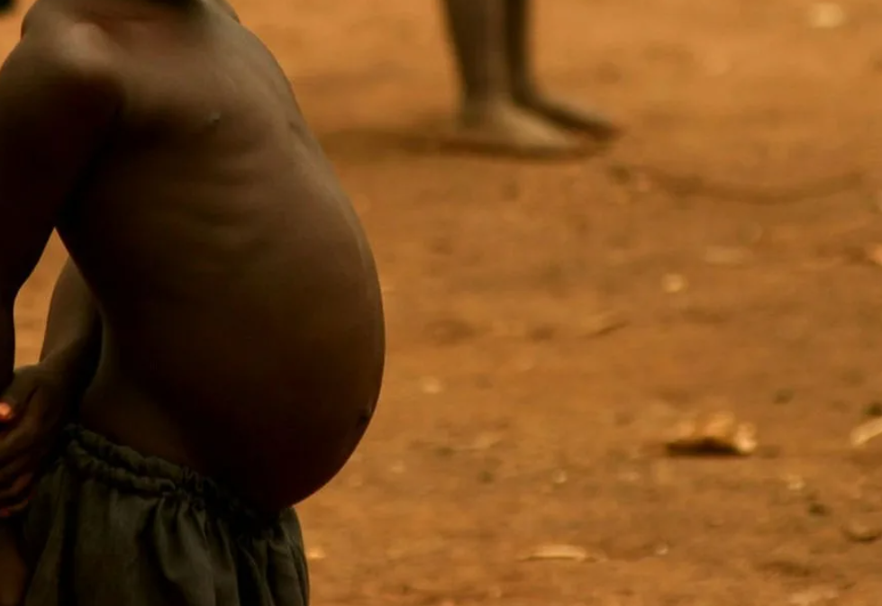 Почему у африканских детей часто бывают такие большие животы?