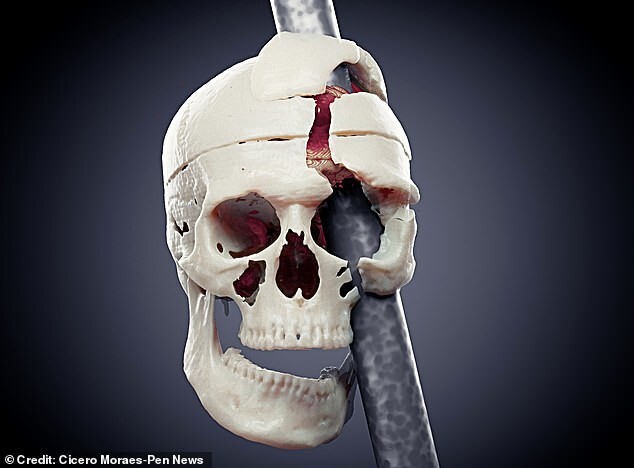 Учёные показали  лицо Финеаса Гейджа через мгновение после несчастного случая