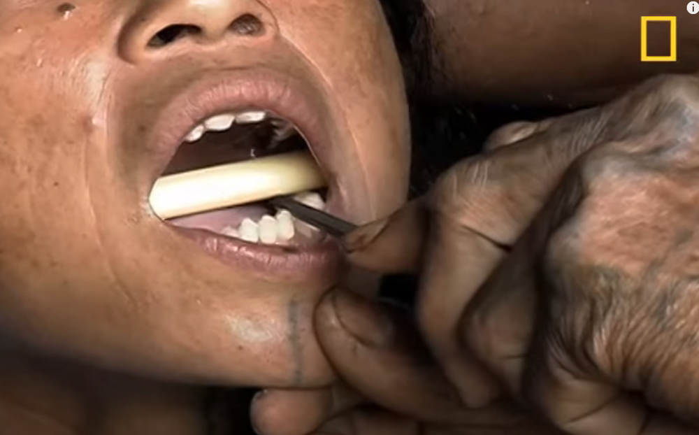 Красота по-индонезийски – заточенные акульи зубы