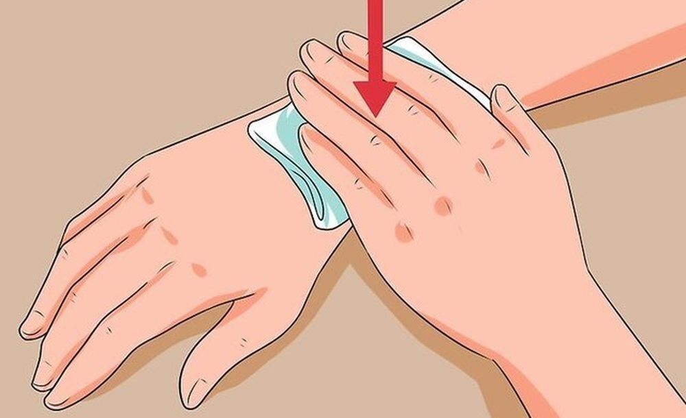 Чем обрабатывать рану после укуса