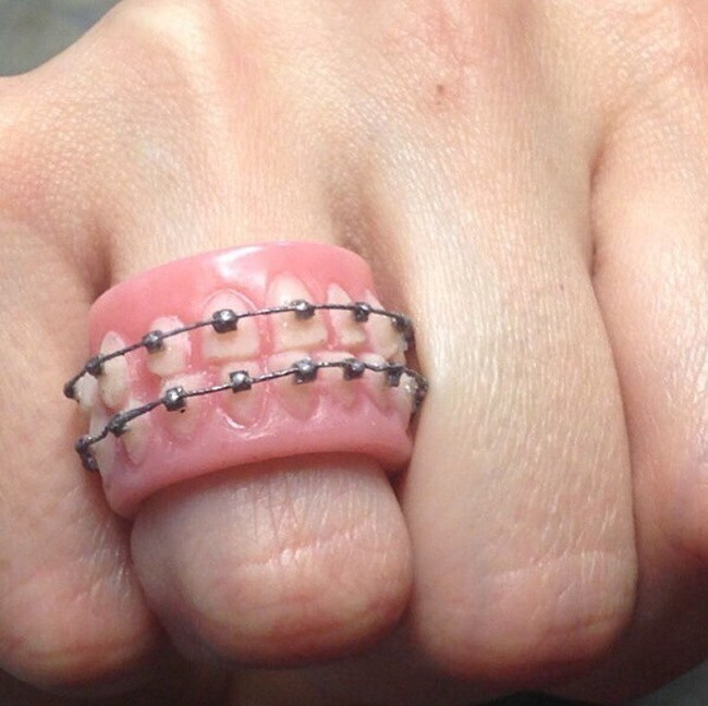 5. Идеальное кольцо стоматолога