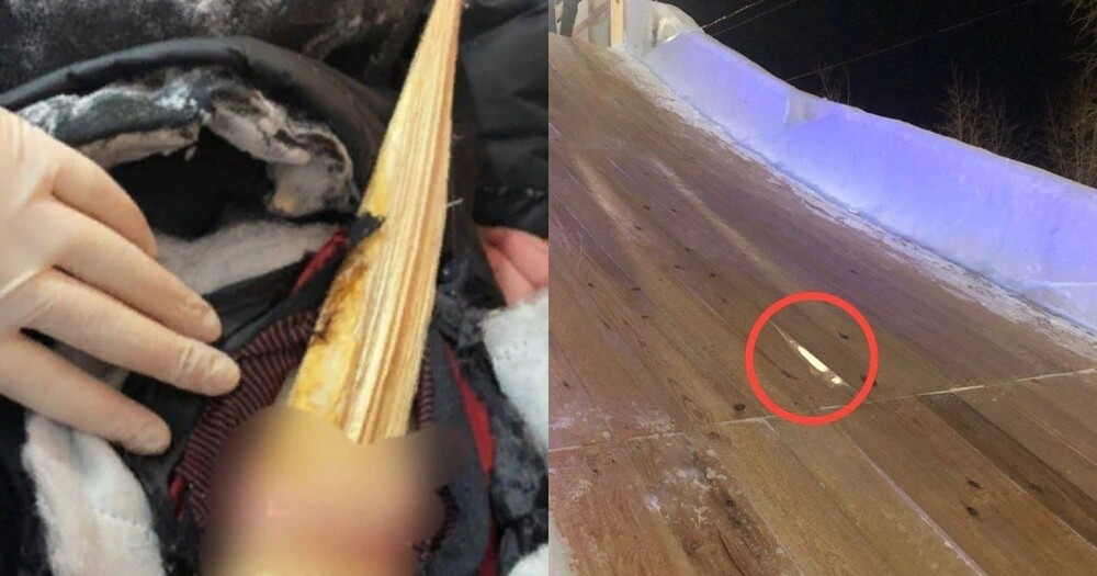 В Свердловской области подросток скатился с деревянной горки и нашёл себе проблему на пятую точку