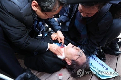 В Южной Корее лидера оппозиционной партии ударили ножом в шею