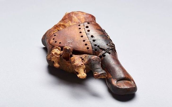 5. Останки мумии возрастом около 3000 лет с протезом пальца ноги