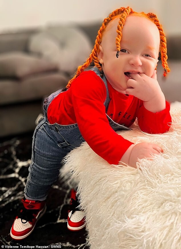У чернокожих родителей получился ребёнок-альбинос с рыжими волосами