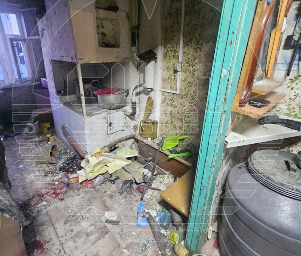 В Иркутской области семикласснице оторвало руки взрывом от зарядки смартфона