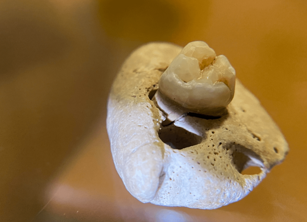 24. Парень нашёл в реке камень с человеческим зубом внутри