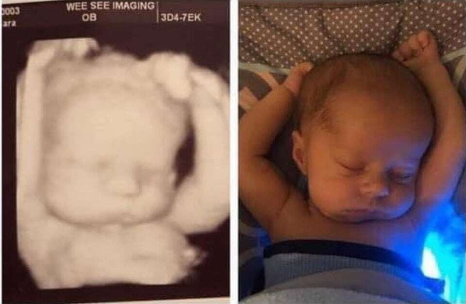 В утробе и после рождения