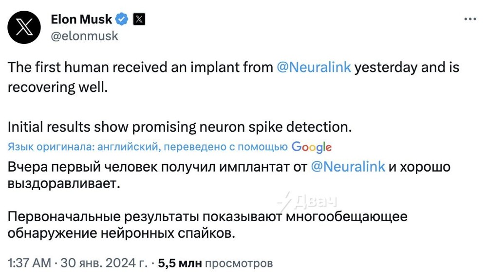 Компания Илона Маска впервые вживила имплант в мозг человека