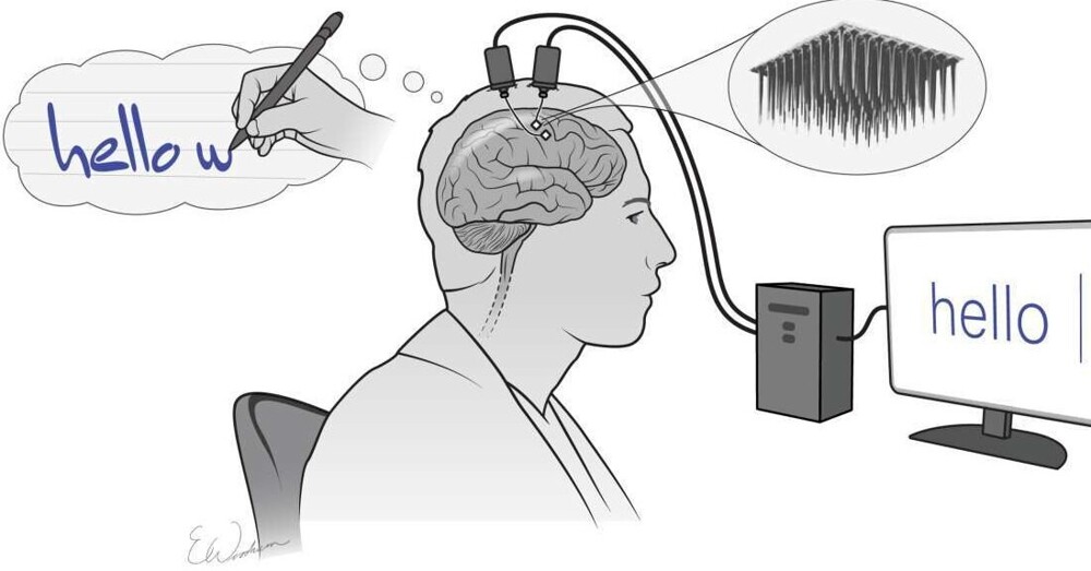 Компания Илона Маска впервые вживила имплант в мозг человека