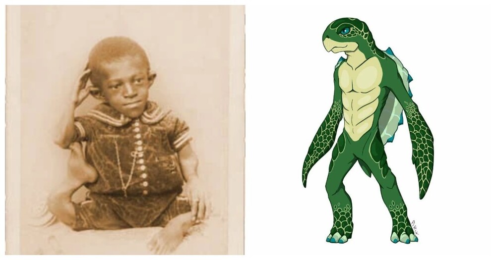 Джордж Уильямс – мальчик-черепаха и его история