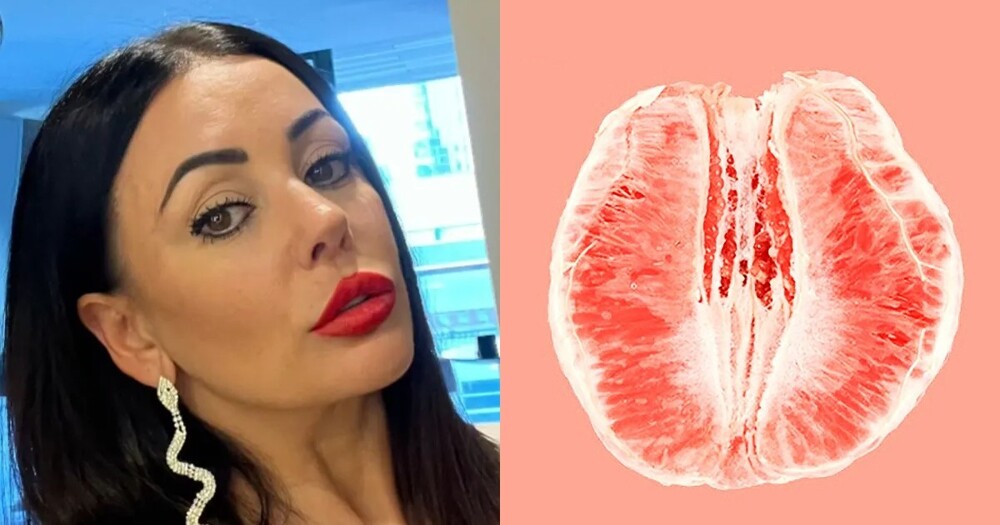 47-летняя австралийка решилась на операцию "дизайнерская вагина" - и пожалела