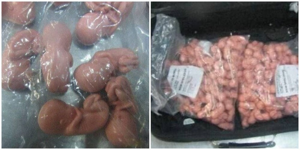 "Не игрушка": на границе России задержали женщину с сотнями эмбрионов в чемодане