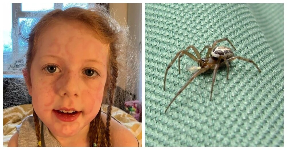 Самый опасный паук Великобритании укусил 5-летнюю девочку