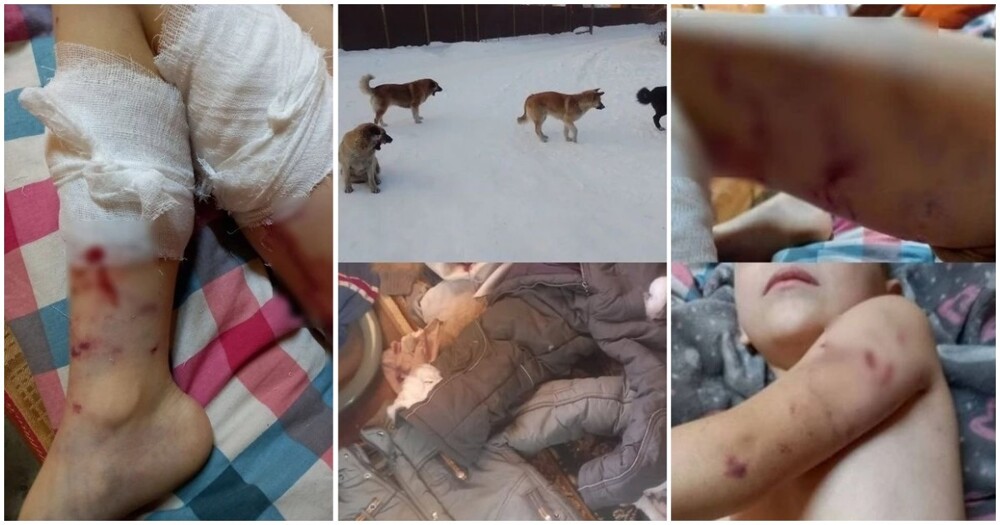 Стая собак напала на пятилетнего мальчика в Шелехове
