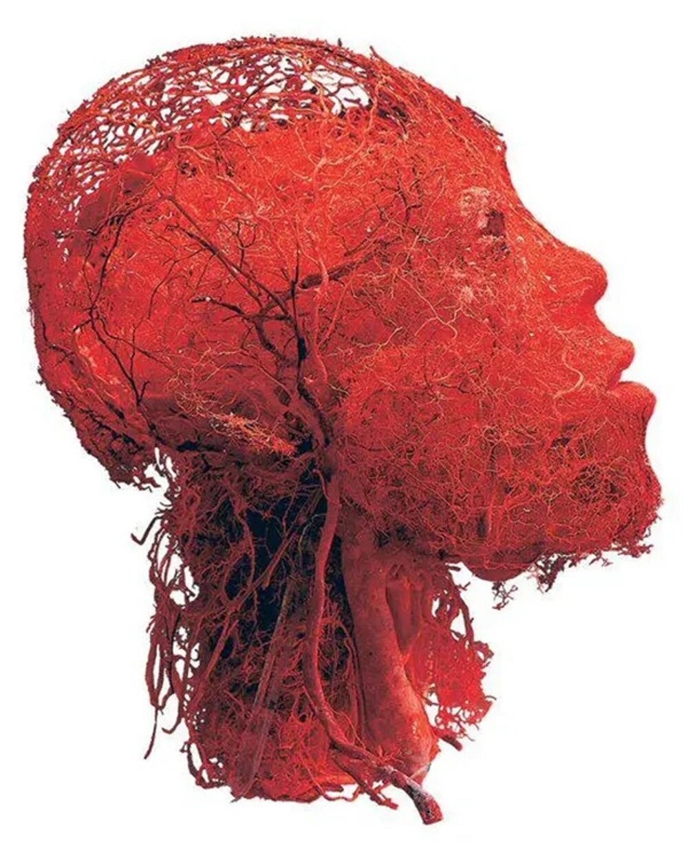 17. Кровеносные сосуды в головном мозге и голове