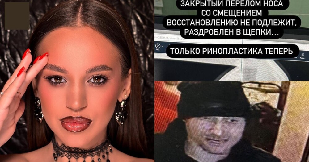 В Челябинске мужик, которого не пустили в бар, от обиды сломал нос девушке и сбежал